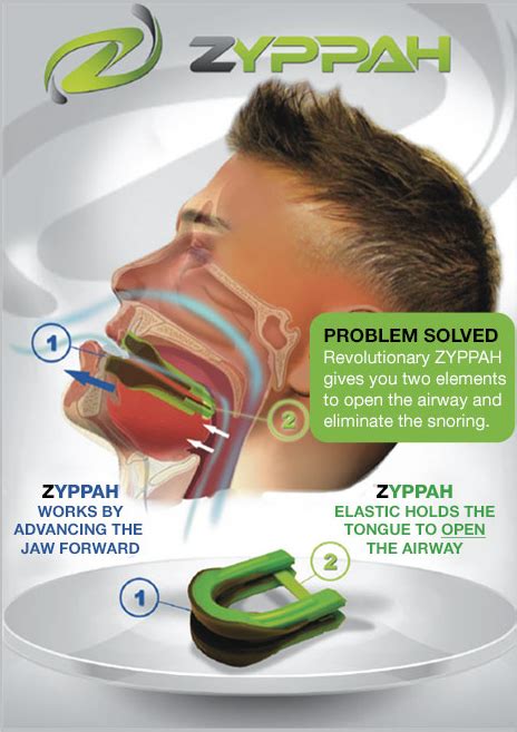zyppah instructions|zyppah pro for sleep apnea.